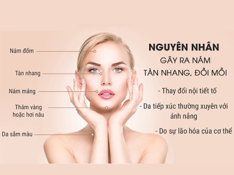 Những nguyên nhân gây nám ảnh hưởng tới cuộc sống của bạn